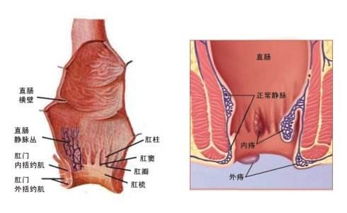 肛门长包.jpg